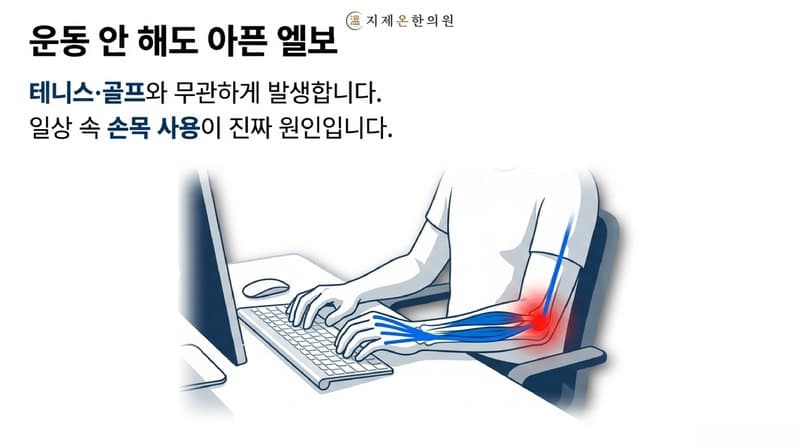 평택 테니스엘보·골프엘보 한의원, 테니스도 골프도 안 치는데 왜 아플까