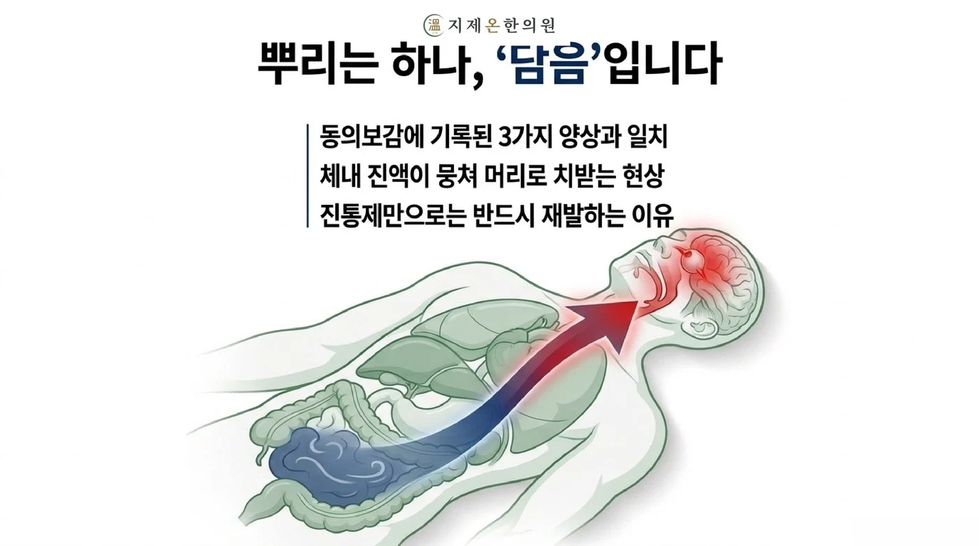 동의보감에 기록된 세 가지 두통 양상의 뿌리가 담음이라는 설명, 몸 안의 진액이 뭉쳐 머리로 치받는 그림