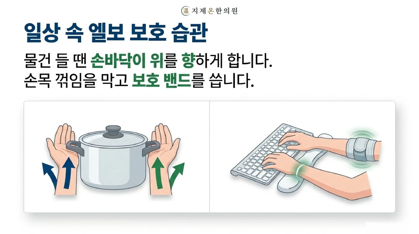 물건을 들 때 손바닥이 위를 향하게 하고 손목 받침과 팔꿈치 보호 밴드를 쓰는 생활 습관