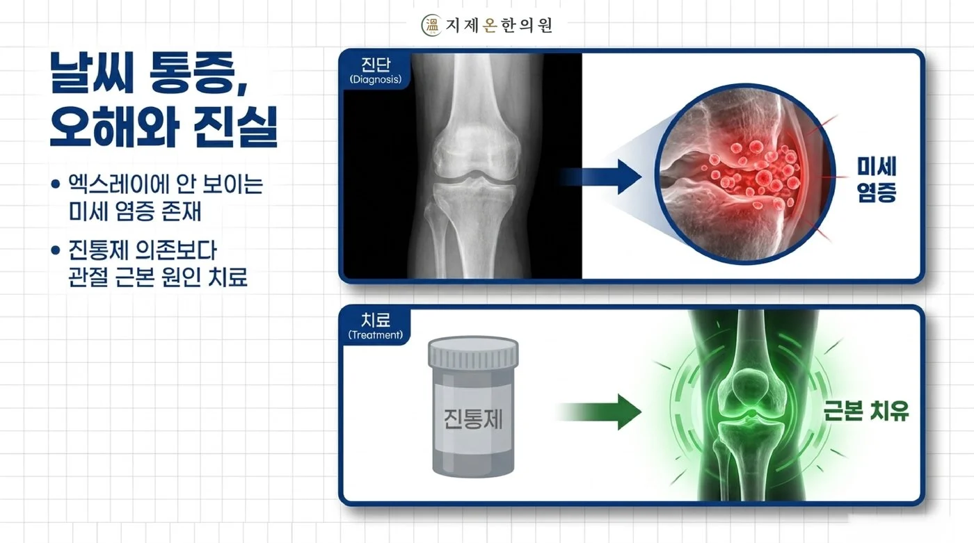 엑스레이에 잘 보이지 않는 관절의 미세 염증과, 진통제보다 원인을 먼저 확인해야 하는 이유